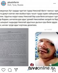 В Туве напавшему на него медведю мужчина откусил часть языка. Зверь убежал